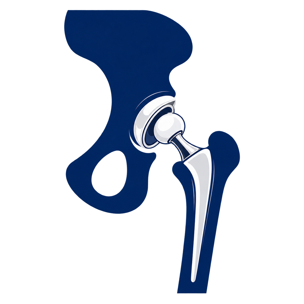 Digital illustration of a human pelvis with a highlighted hip joint and femur, showing the anatomical structure.