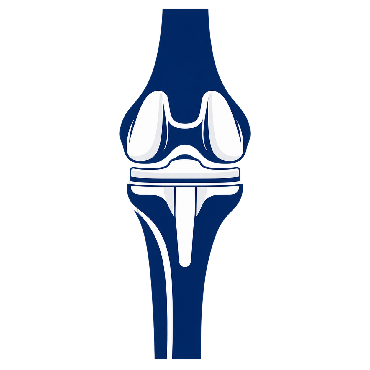 Illustration of a human knee joint with bone, cartilage, and ligaments. The image shows the lower end of the thigh bone (femur), the upper end of the shin bone (tibia), and the kneecap (patella).