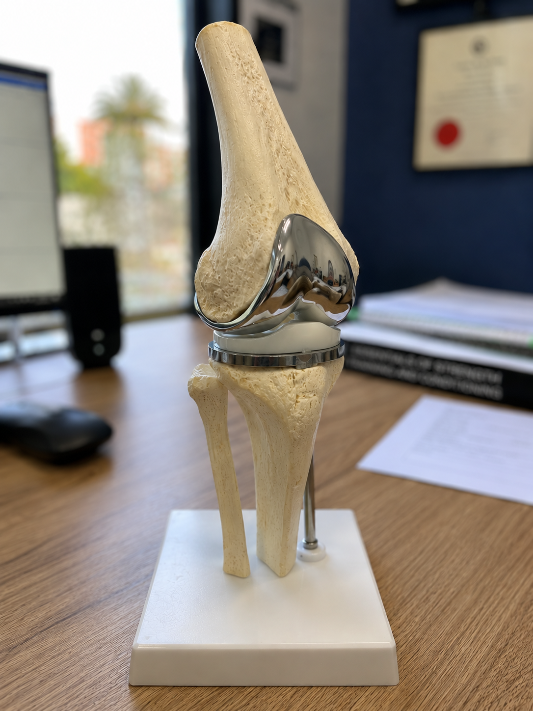 An anatomical model of a human knee joint, showing bones, cartilage, and a metal implant on a desk in an office.