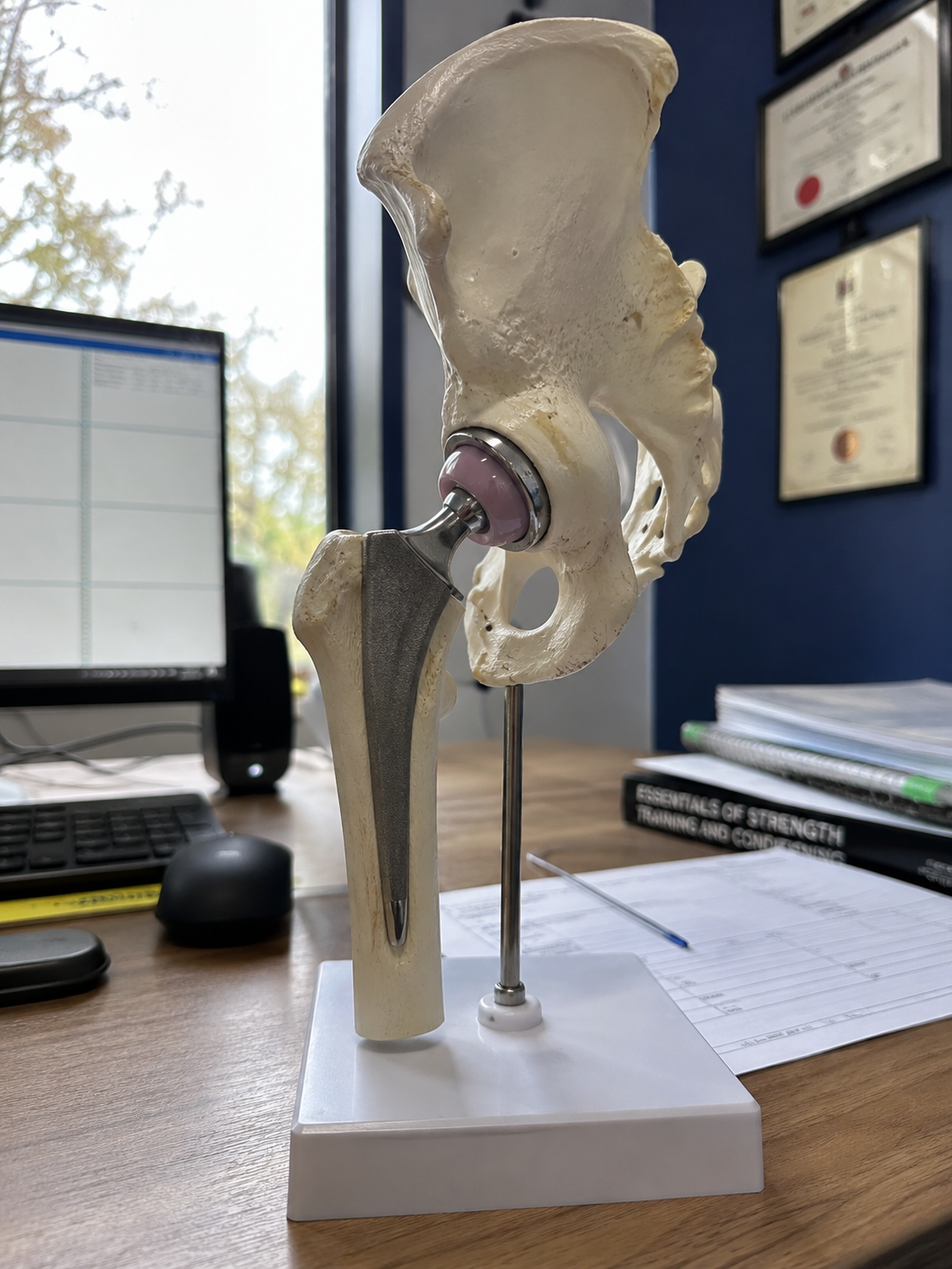 Model of a human hip joint showing femur, pelvis, and hip socket on a desk with office supplies and medical certificates on the wall