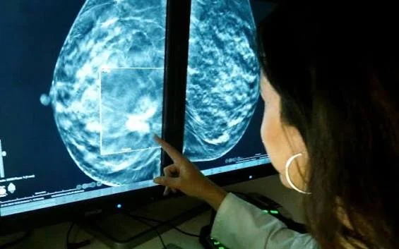 Mujer analizando mamografía en pantalla de computadora.