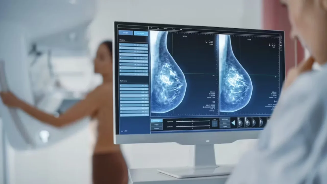 Pantalla de mamografía digital mostrando dos imágenes de senos en un entorno clínico