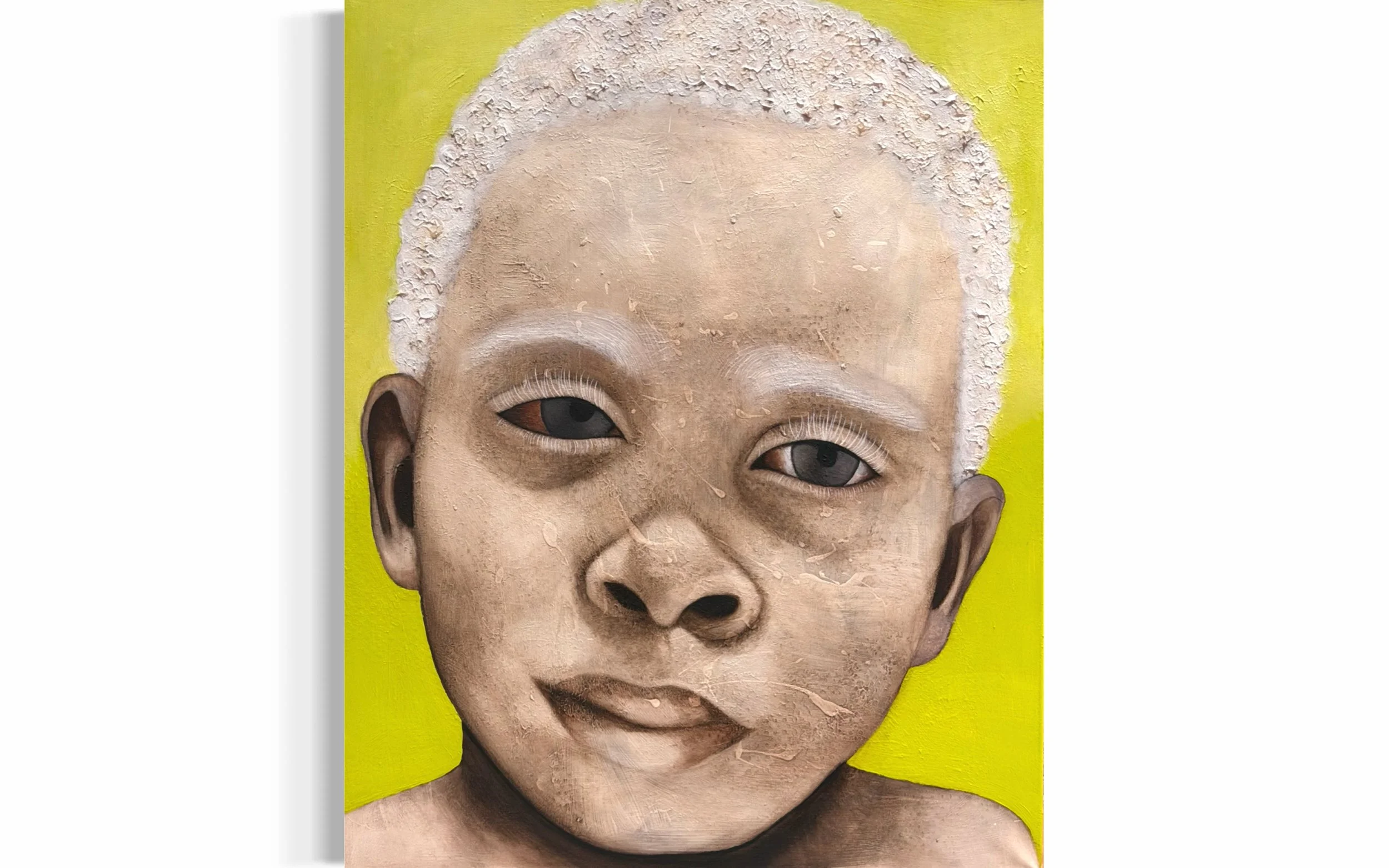 Niño Albino
