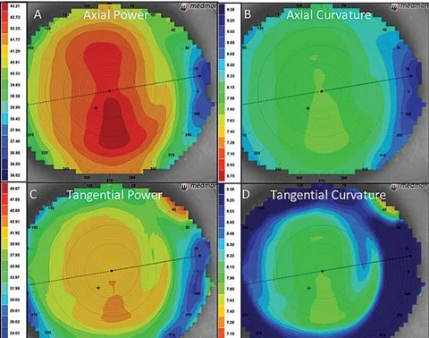 Four color-coded contour maps showing axial Power, axial Curvature, Tangential Power, and Tangential Curvature, used in eye measurements.