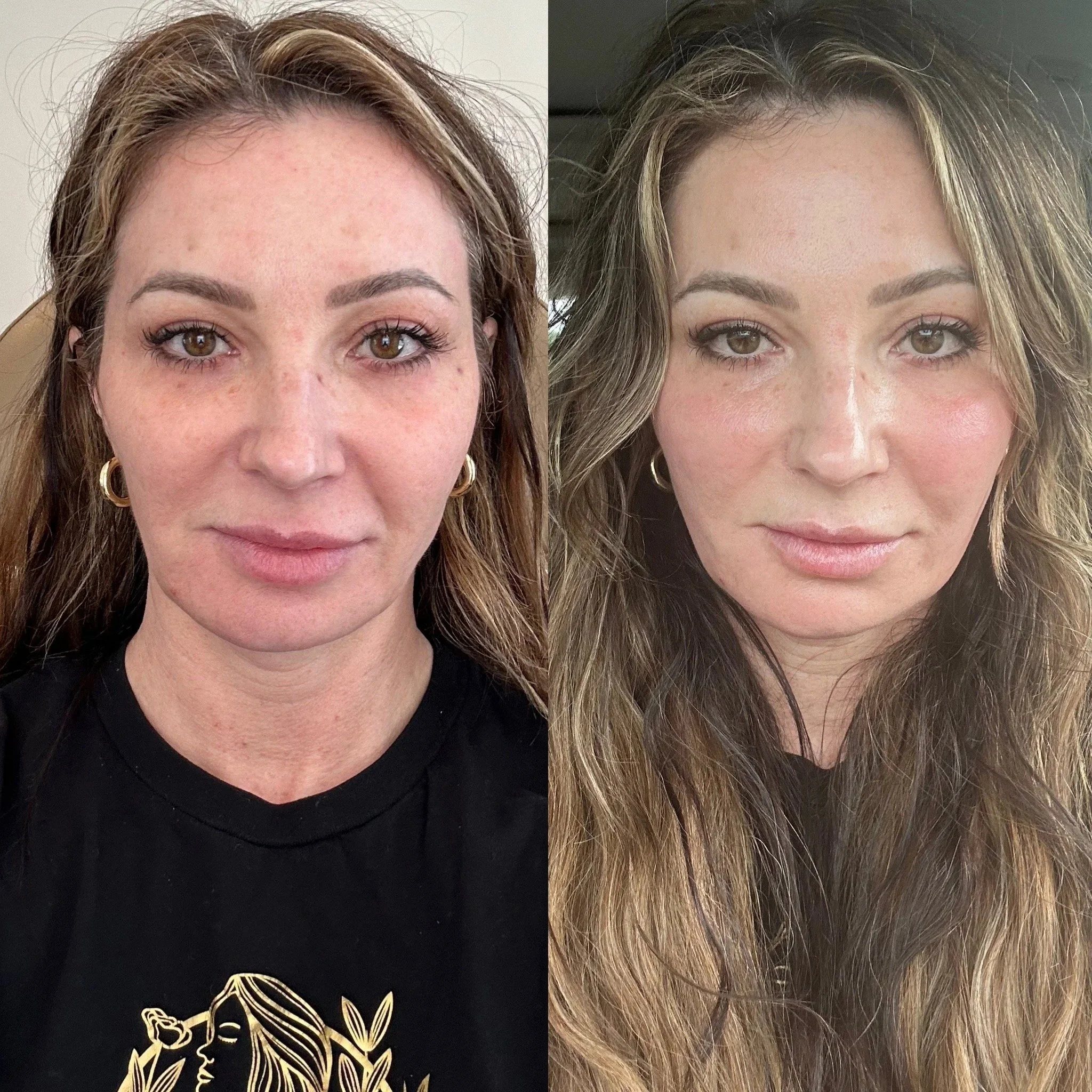 Tixel: The Game-Changer for Eyes, Neck, and Beyond