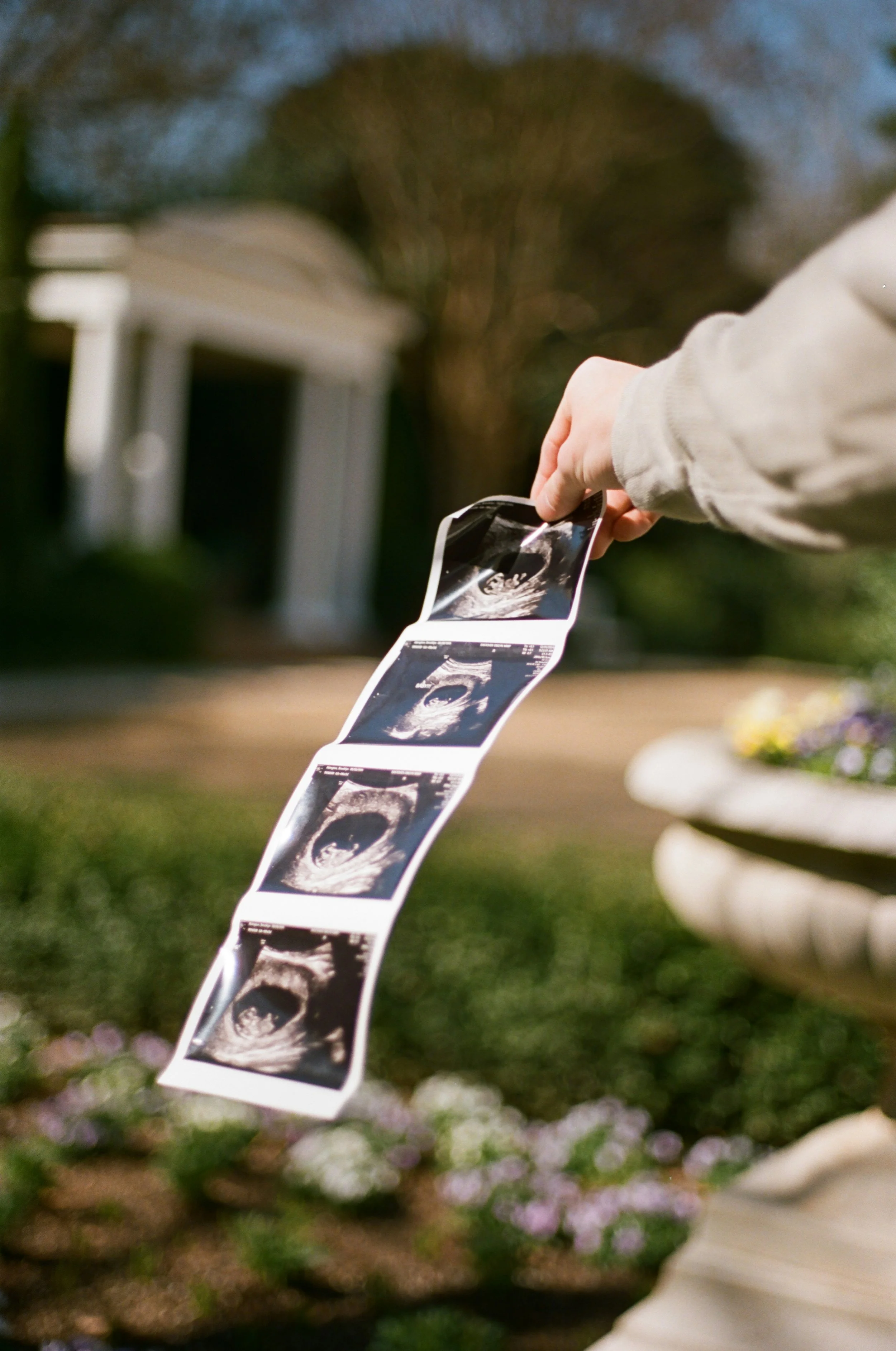Person holding ultrasound scans outdoors in front of a white building and trees.