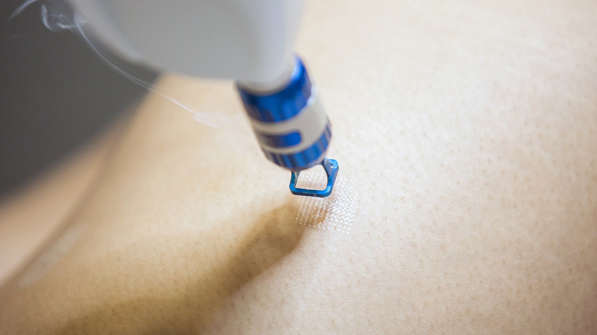 Close-up of a medical device, possibly a laser or light therapy tool, emitting light onto skin.