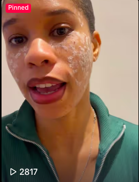 Close-up of a person with short hair and a green zip-up hoodie, with facial products applied on their face, in an indoor setting.