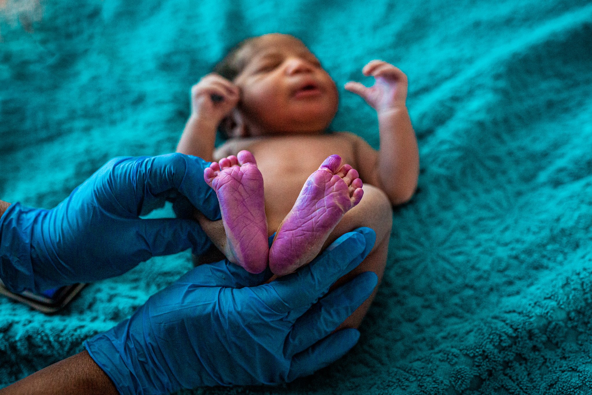 Newborn baby lying on a turquoise blanket with feet facing forward and arms near the face, while a medical professional wearing blue gloves gently holds the baby's ankles.