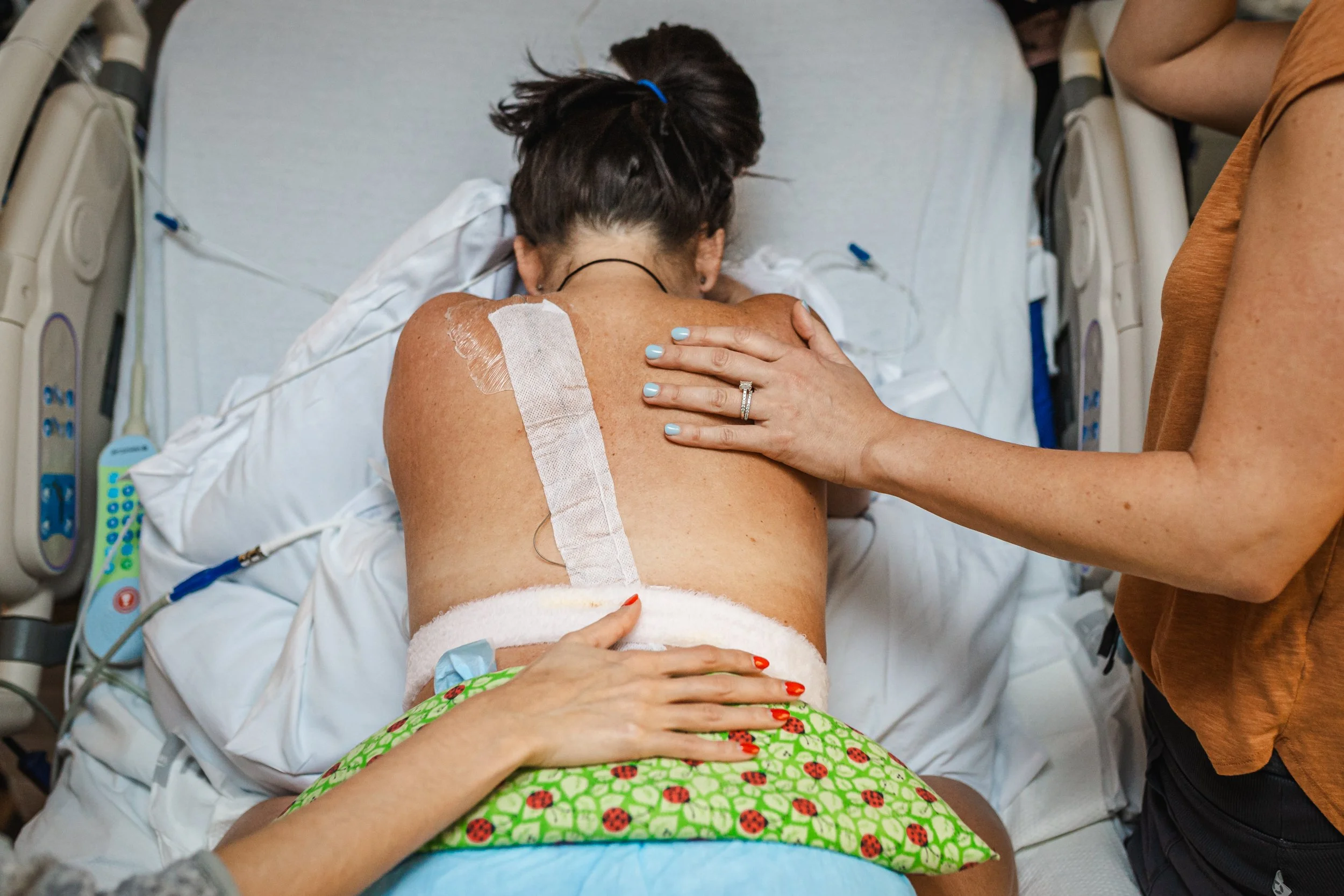 A woman with dark hair in a ponytail is lying face down in a hospital bed. She has a bandage and medical tape on her back, where a medical procedure was performed. A person's hand, with painted nails and a ring, gently rests on her shoulder, providin