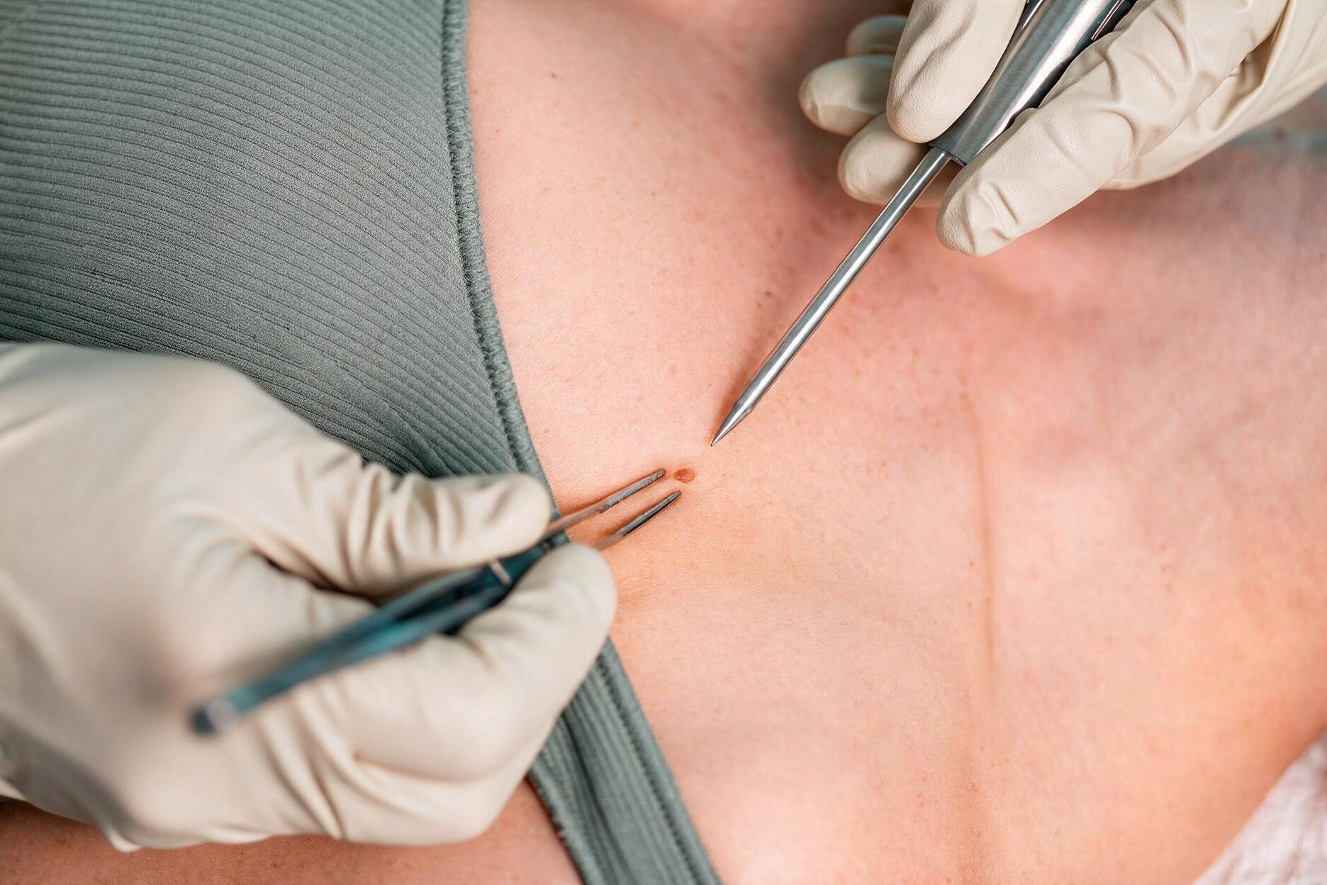 Surgical Dermatology