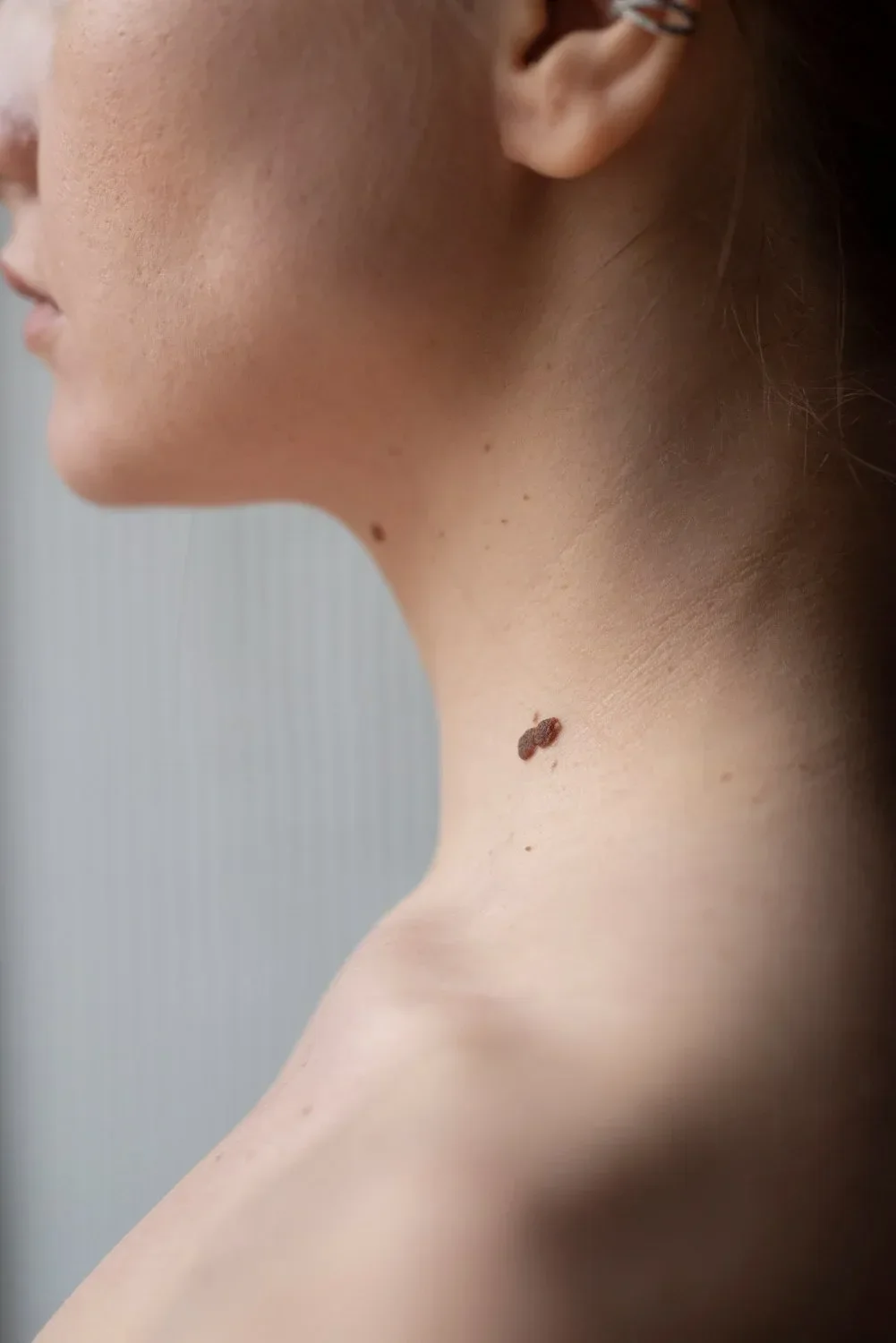Close-up of a woman's neck showing a mole and small skin imperfections.
