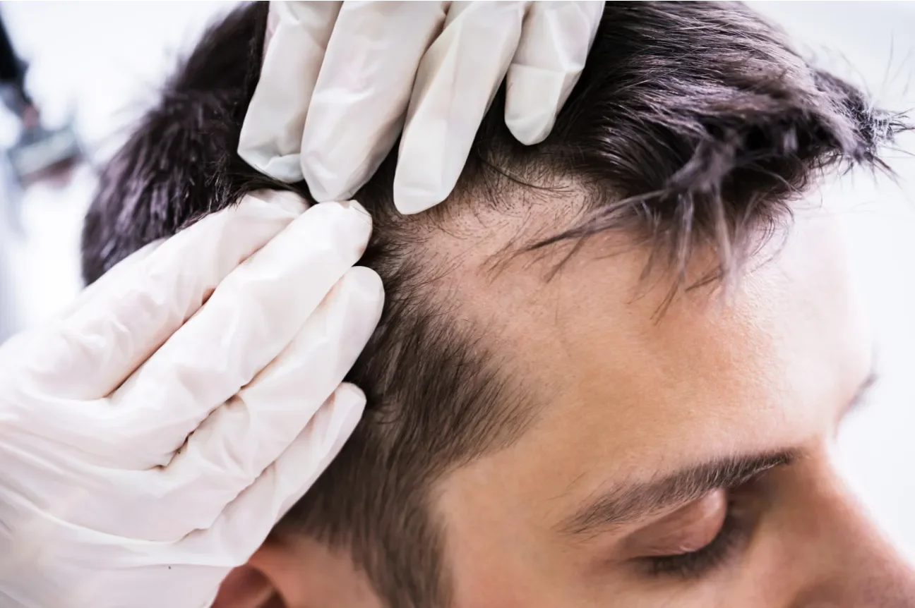 Person receiving a hair examination or treatment from a professional wearing glove.