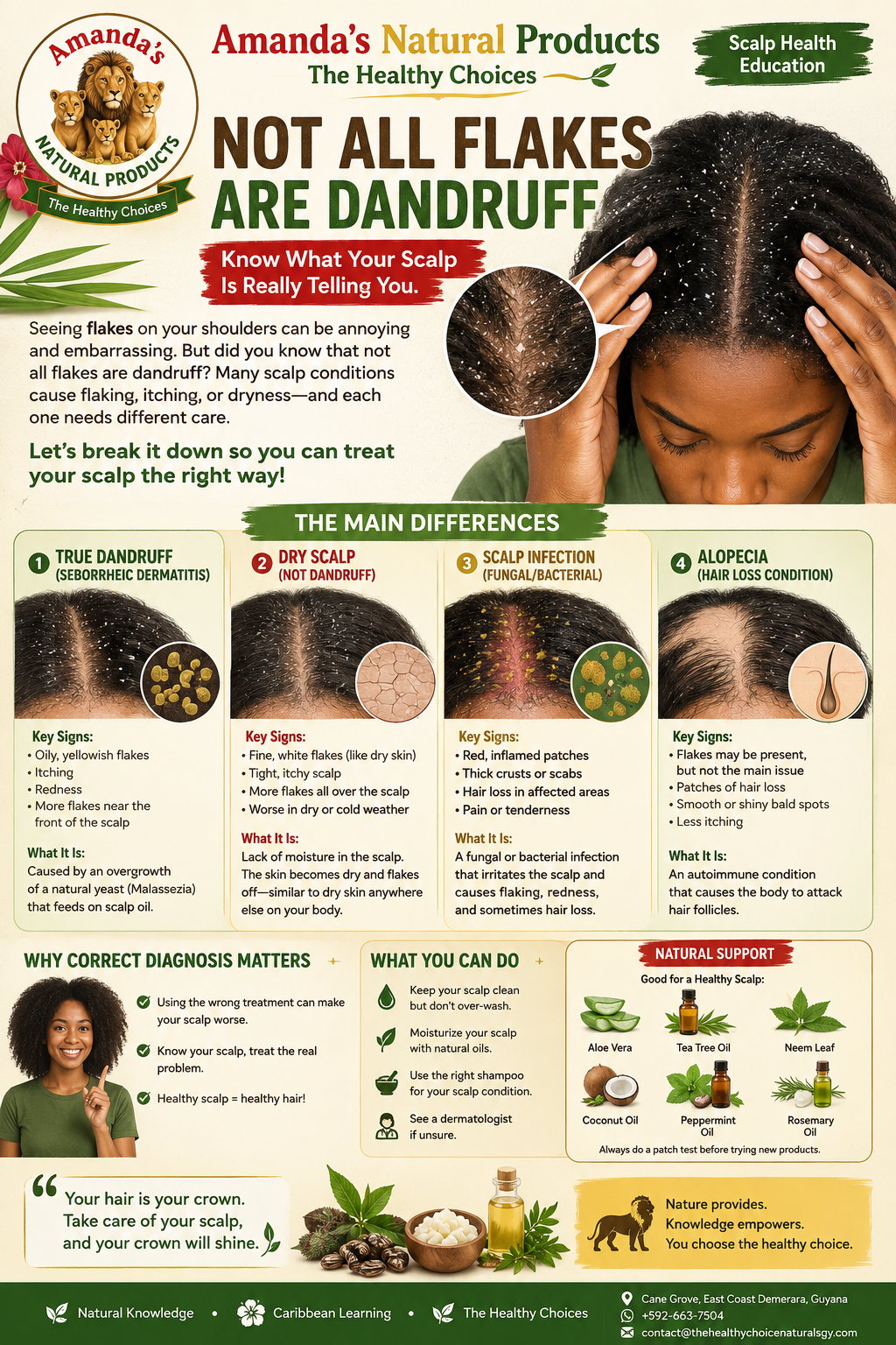 Not All Flakes Are Dandruff: Know What Your Scalp Is Telling You