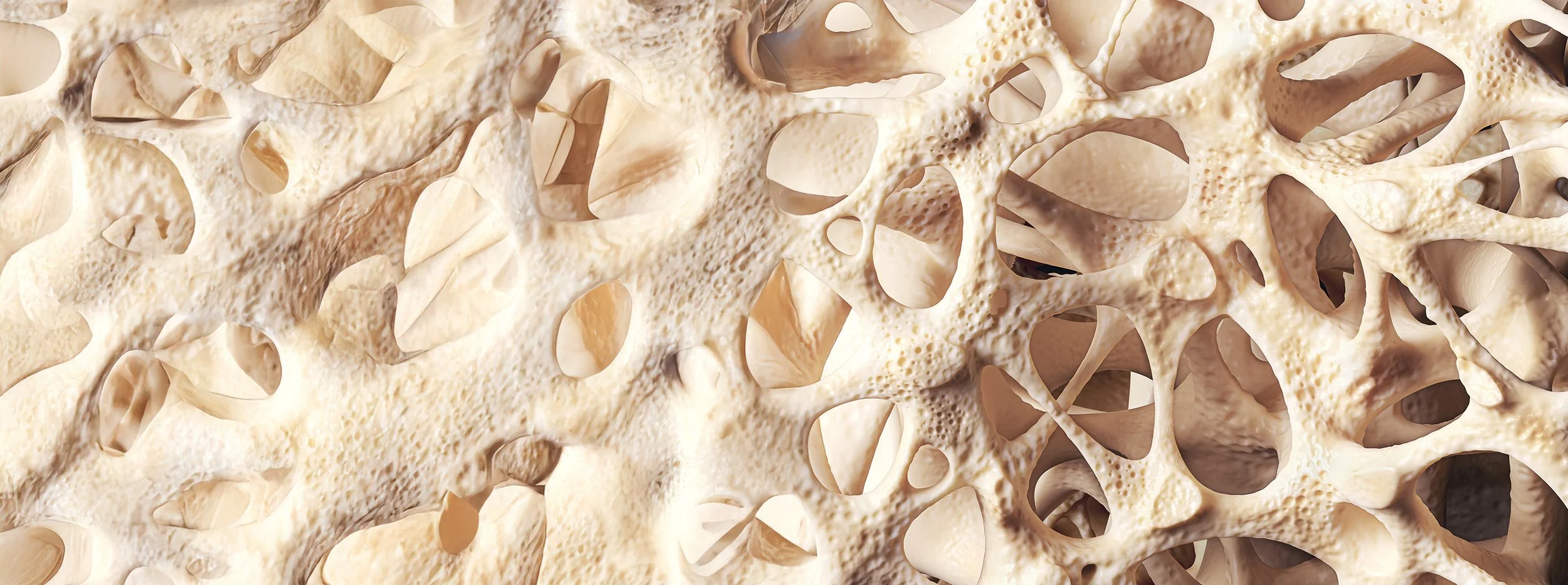 Osteoporosis & Metabolic Bone Disorders Evolve Endocrinology Brighton Melbourne
