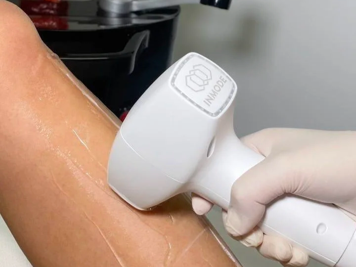 Your First Laser Hair Removal Appointment: What Happens Step by Step