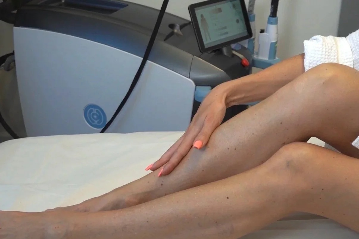 How to Prepare for Laser Hair Removal — and What to Expect After Your Appointment