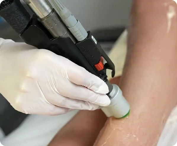 A person in a white glove using a tattoo machine on someone's arm.