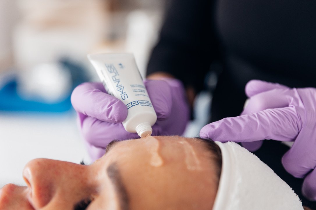 An image of a pre-treatment gel being applied to a woman's face before microneedling treatment at a skin rejuvenation clinic in broadstone