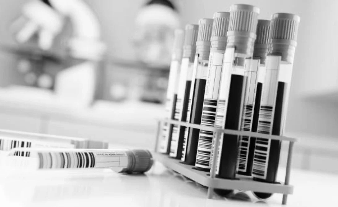 Multiple RNATT blood sample vials with barcodes in a rack at a medical laboratory.
