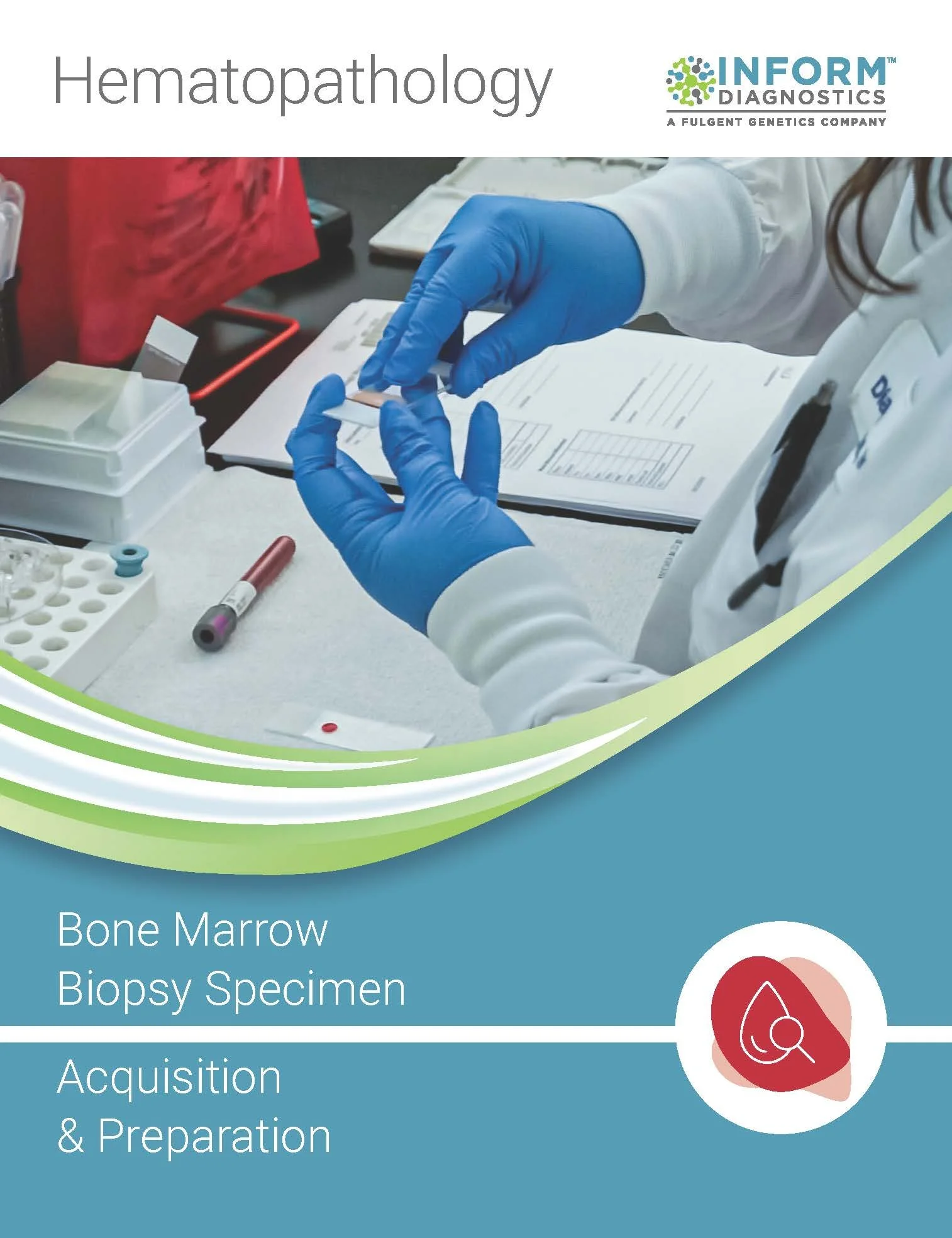 IDX Bone Marrow Biopsy Brochure