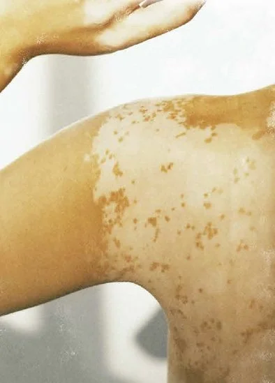 Back_skin.jpg