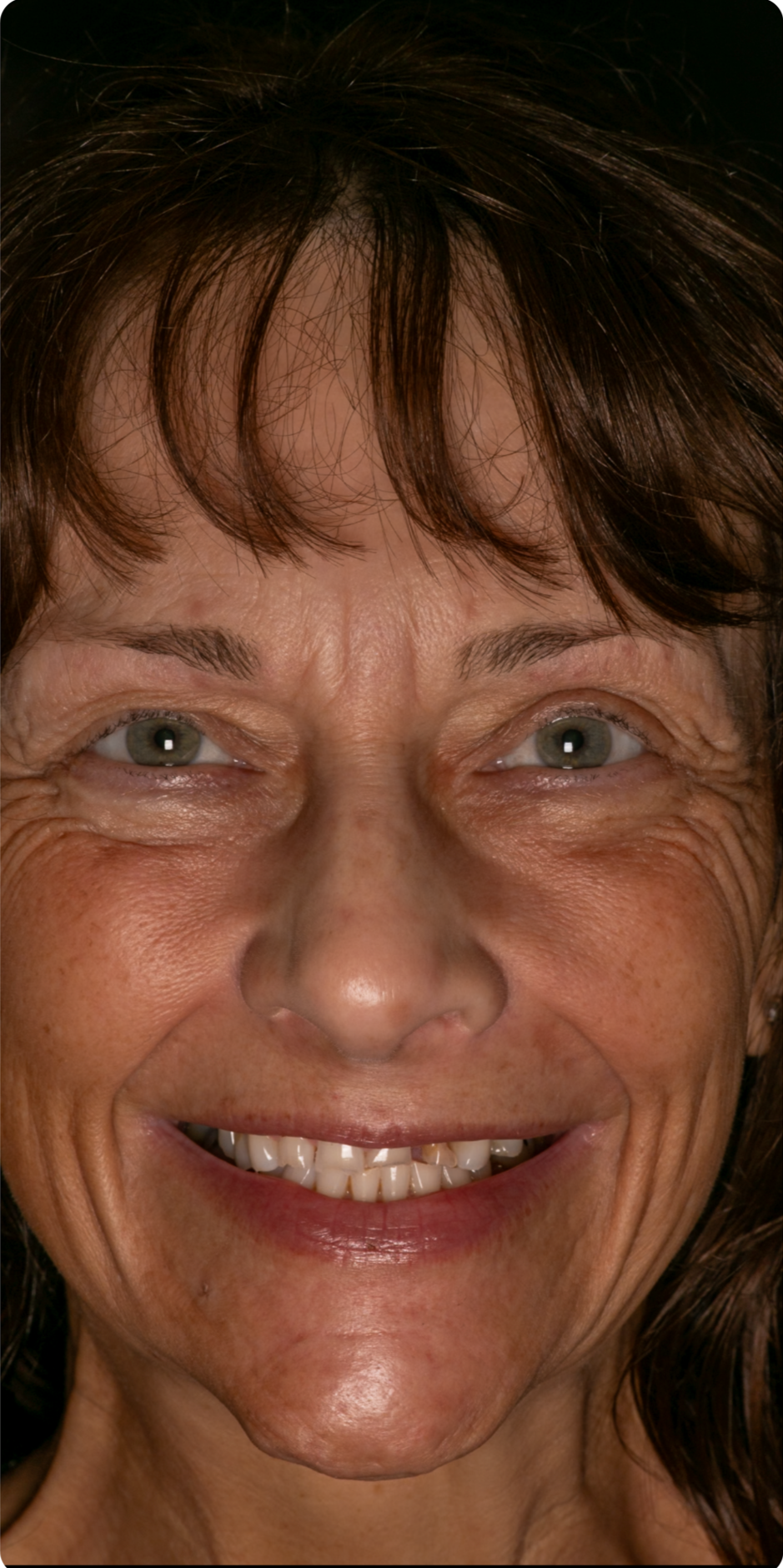 54D87C5C-8500-430F-B8C9-62414C06C73E.png