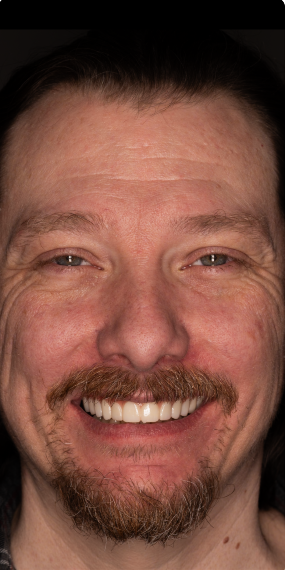 AC33BF65-6F30-43AA-A7EA-26DB9D44C949.png
