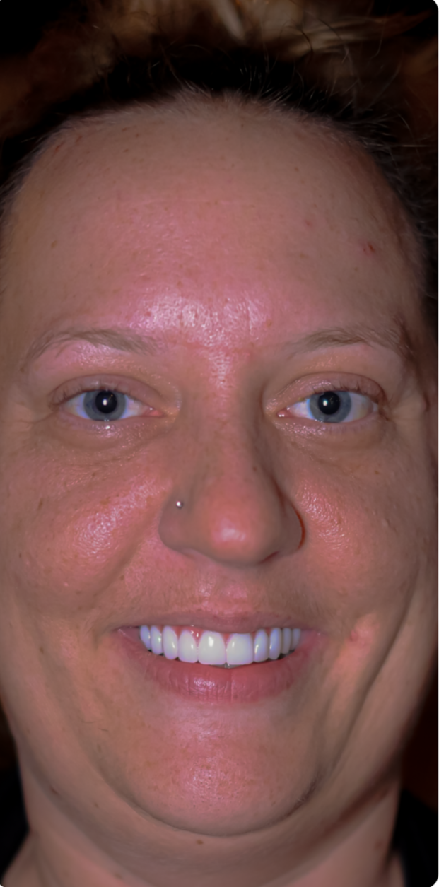 BAF9BE5D-4E1B-4B4C-815A-02D1045E7194.png