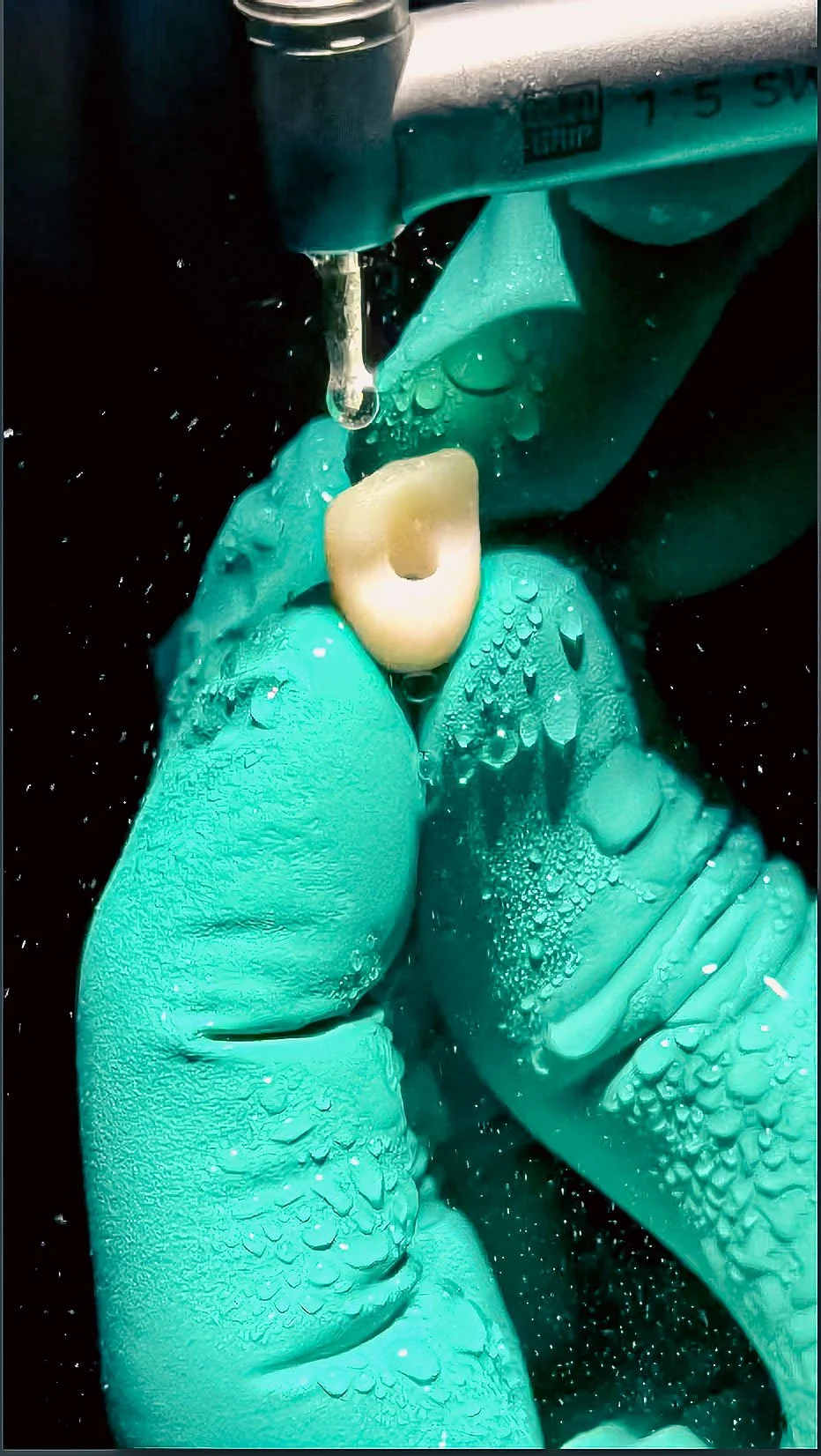 Close-up of a dental procedure with a dentist's gloved hands holding a tooth, water droplets, and dental tools.