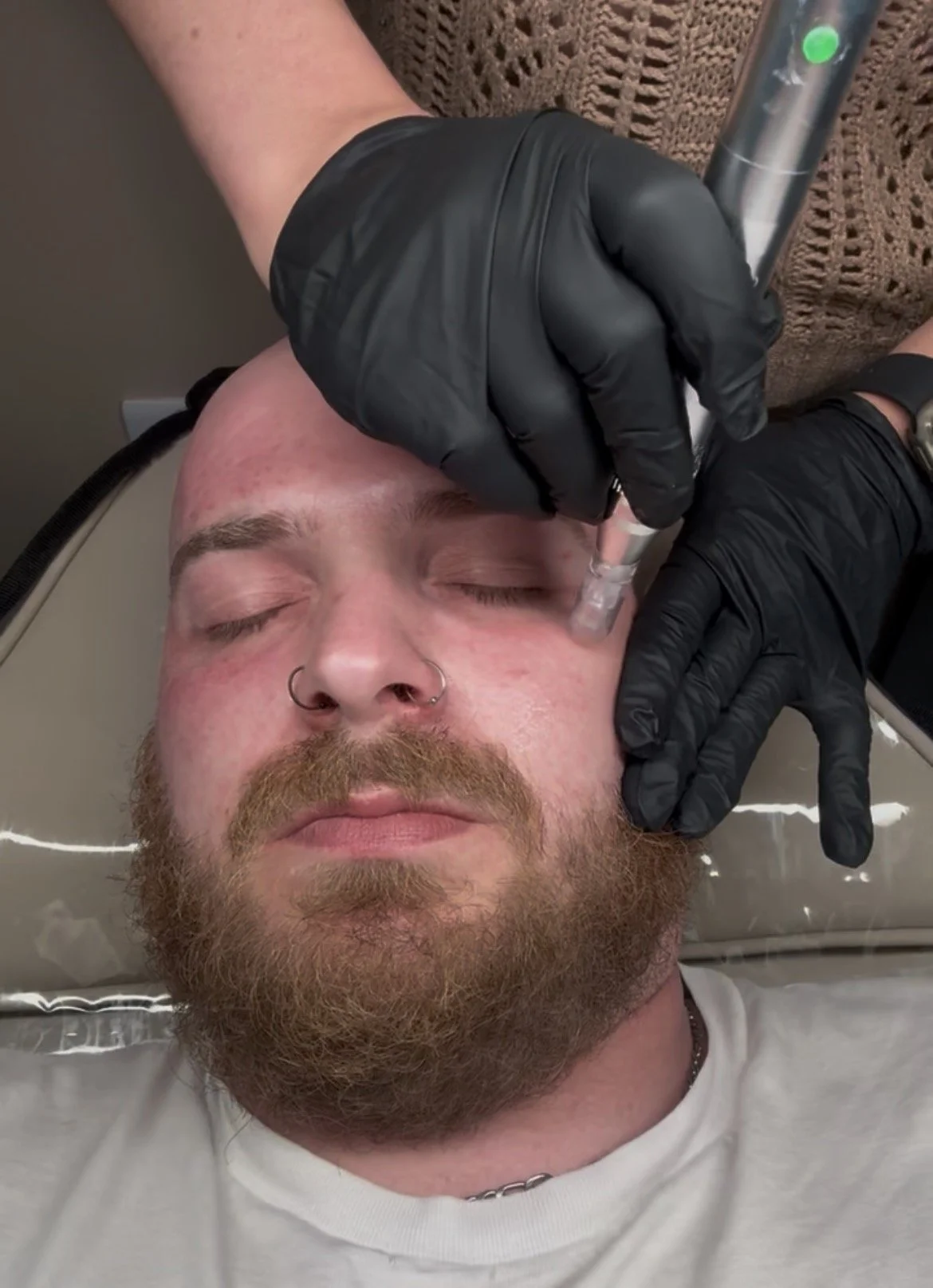 A person with a beard and nose piercings is lying down with eyes closed while a medical professional in black gloves administers a cosmetic injection into their forehead.