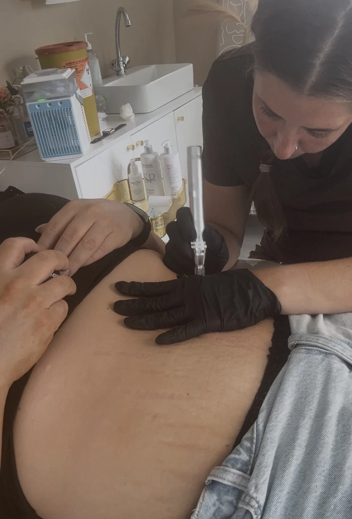 Medical professional performing microneedling on a womans stomach in a clinic setting.