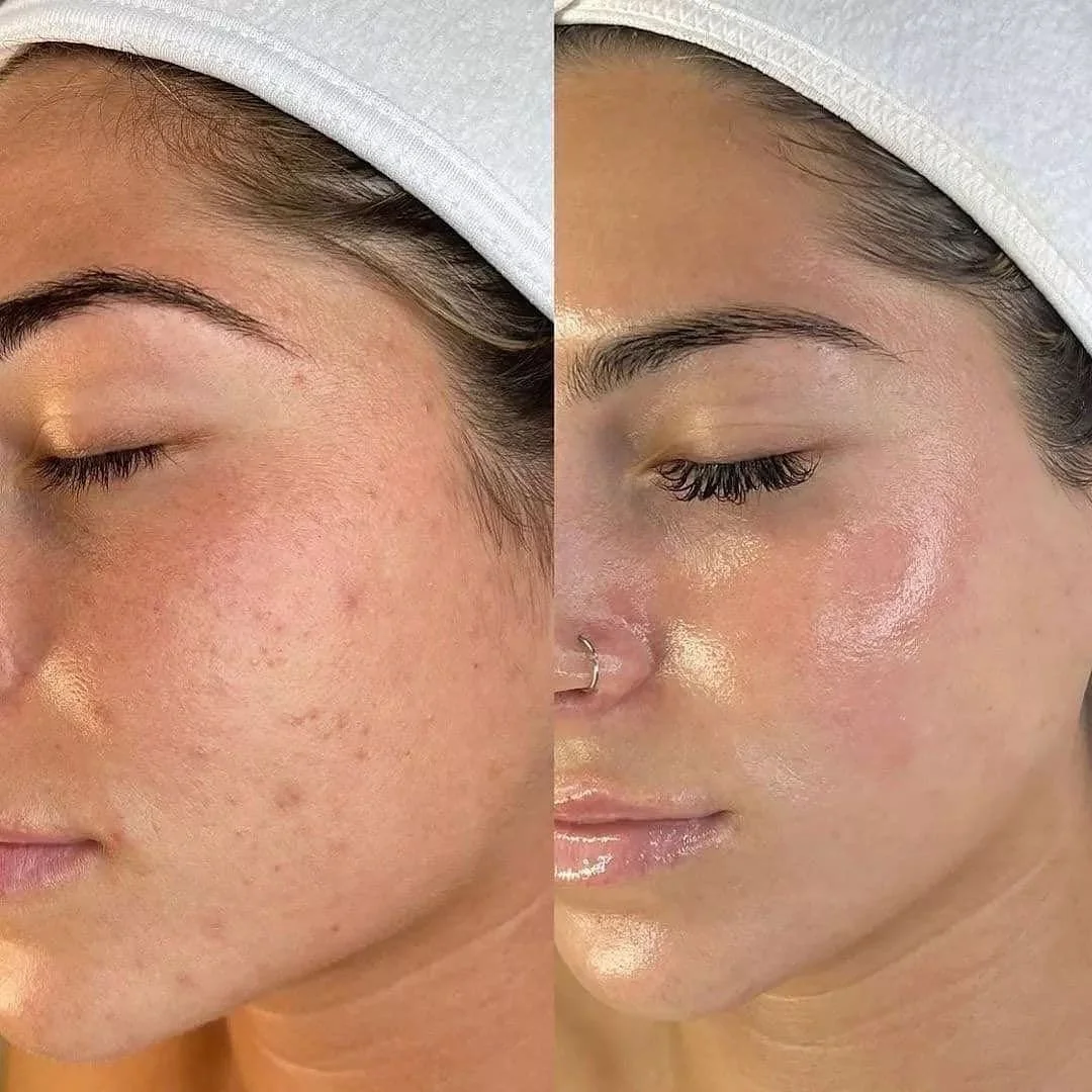 HYDRATE & GLOW FACIAL