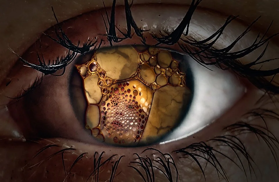Close-up of a human eye with oil and bubbles on the cornea.