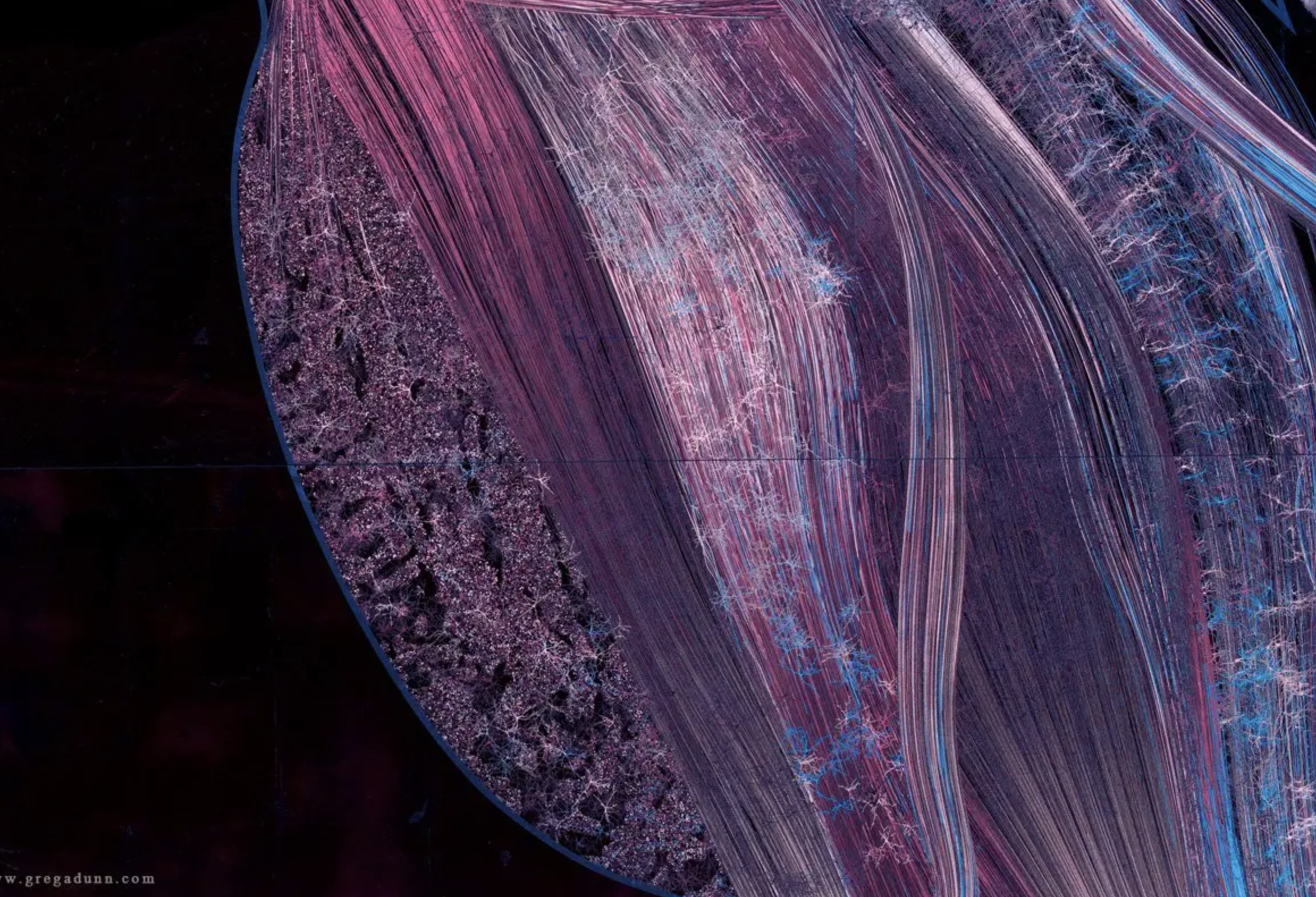 Neuroplasticity: The latest BUZZ word