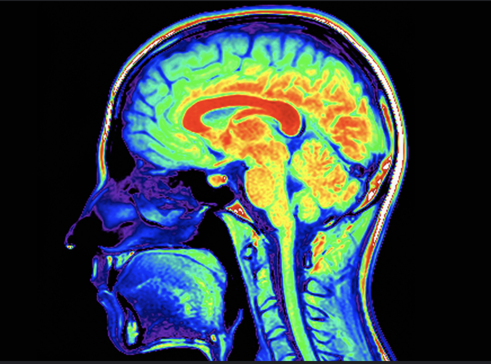 Psilocybin Desynchronizes The Human Brain: Why that’s a good thing!