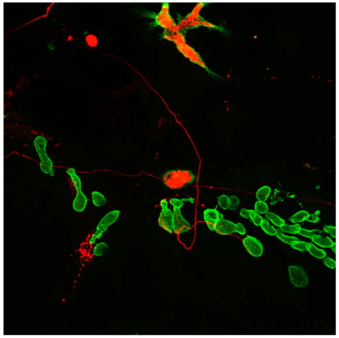 Microscopic image of neurons with fluorescent staining showing green cell bodies and red connections against a black background.