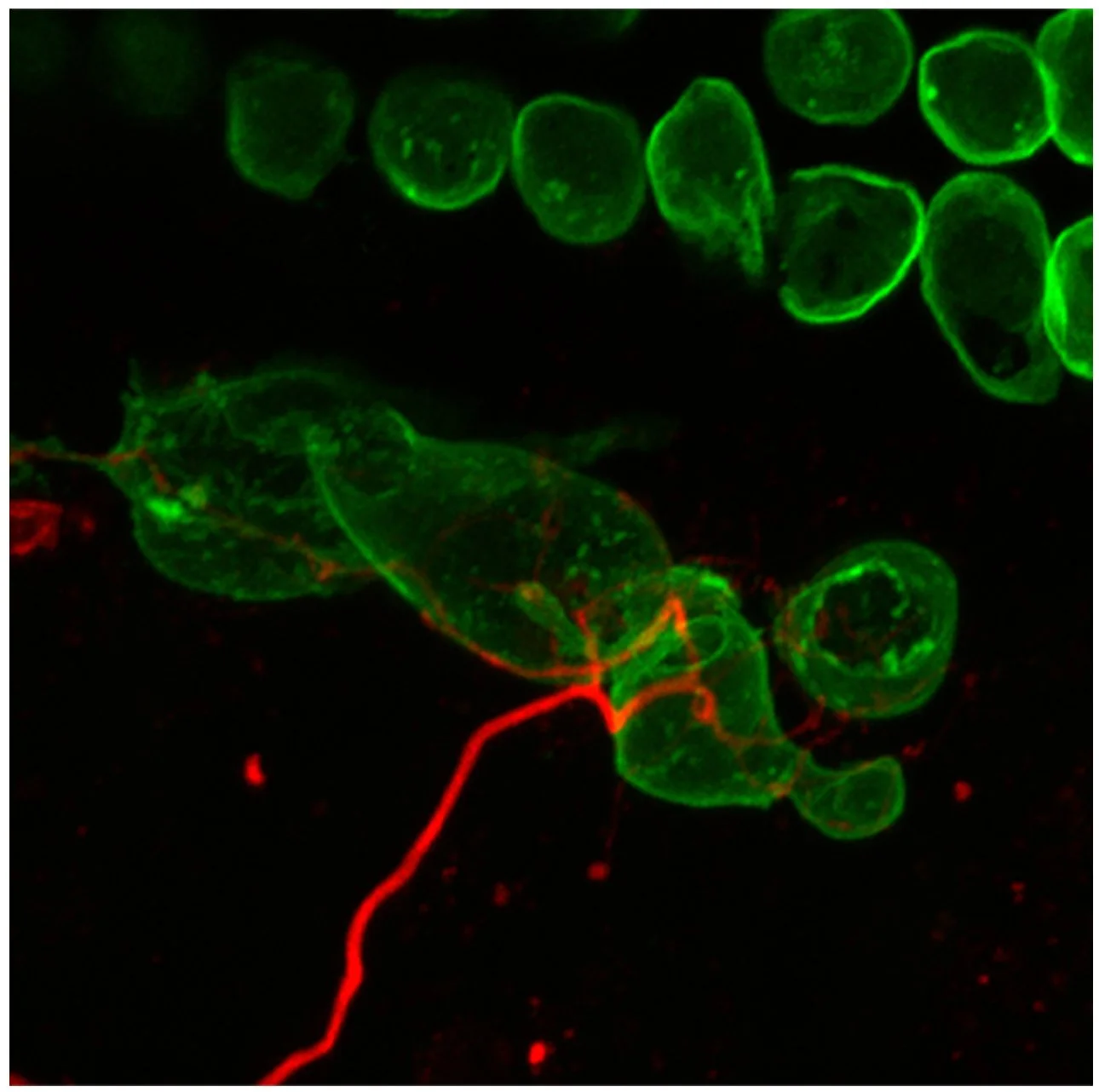 Microscopic image of cells with green and red fluorescent staining on a black background.