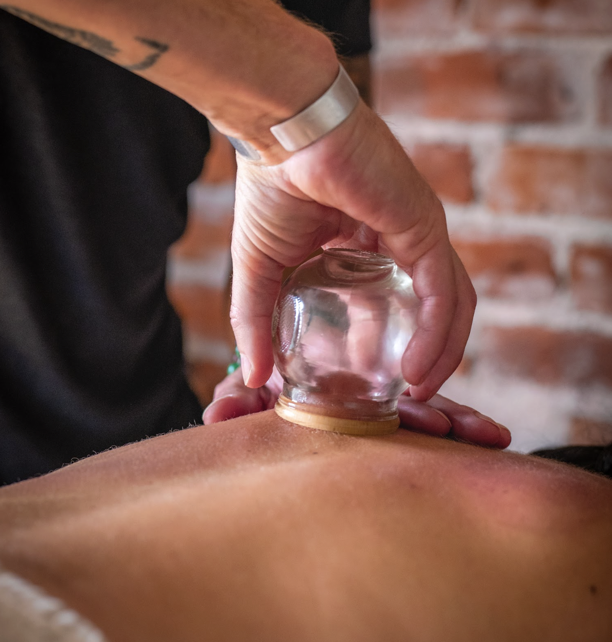 A person receiving a cupping therapy treatment, with a glass cup placed on their back.