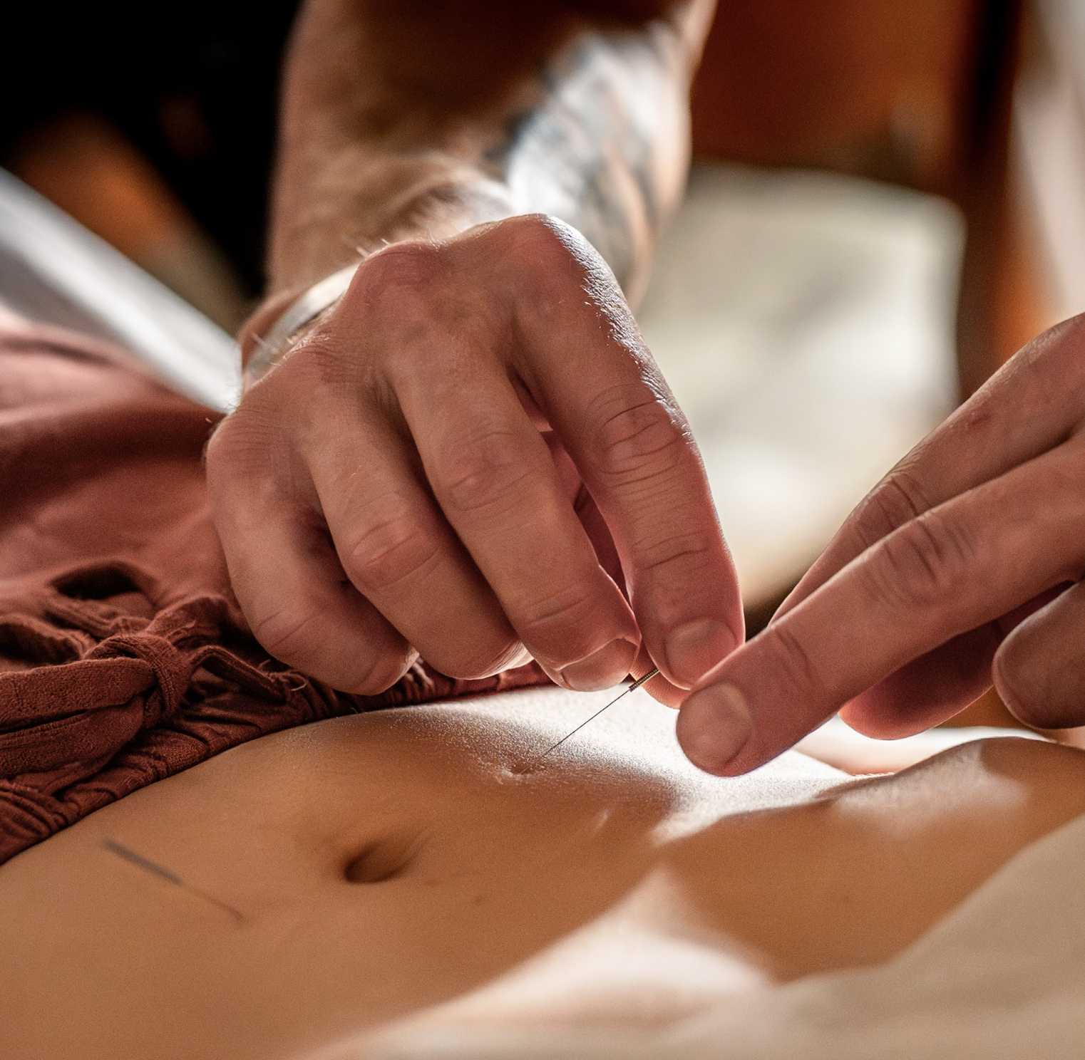 Close-up of a person using a needle to perform acupuncture on a person's stomach