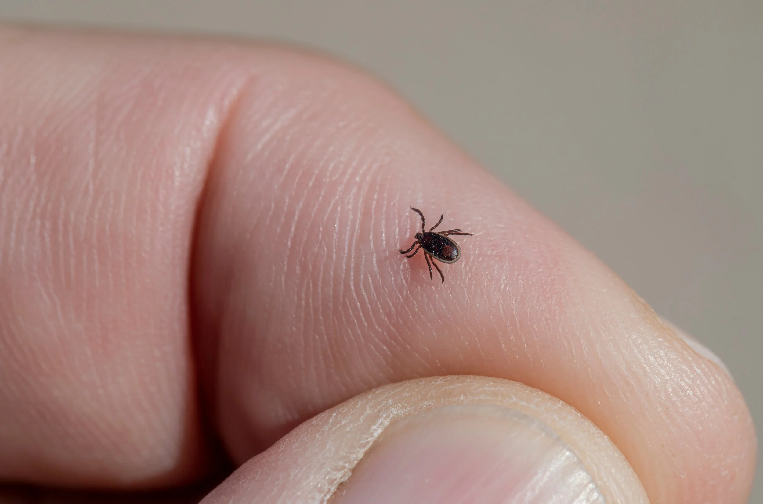 Lyme Disease: The Hidden Impact of a Tiny Bite