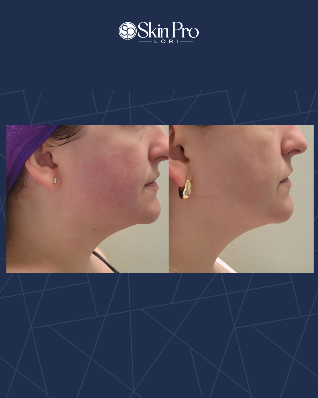 LORIS BEFORE AFTER TEMPLATE (1).png