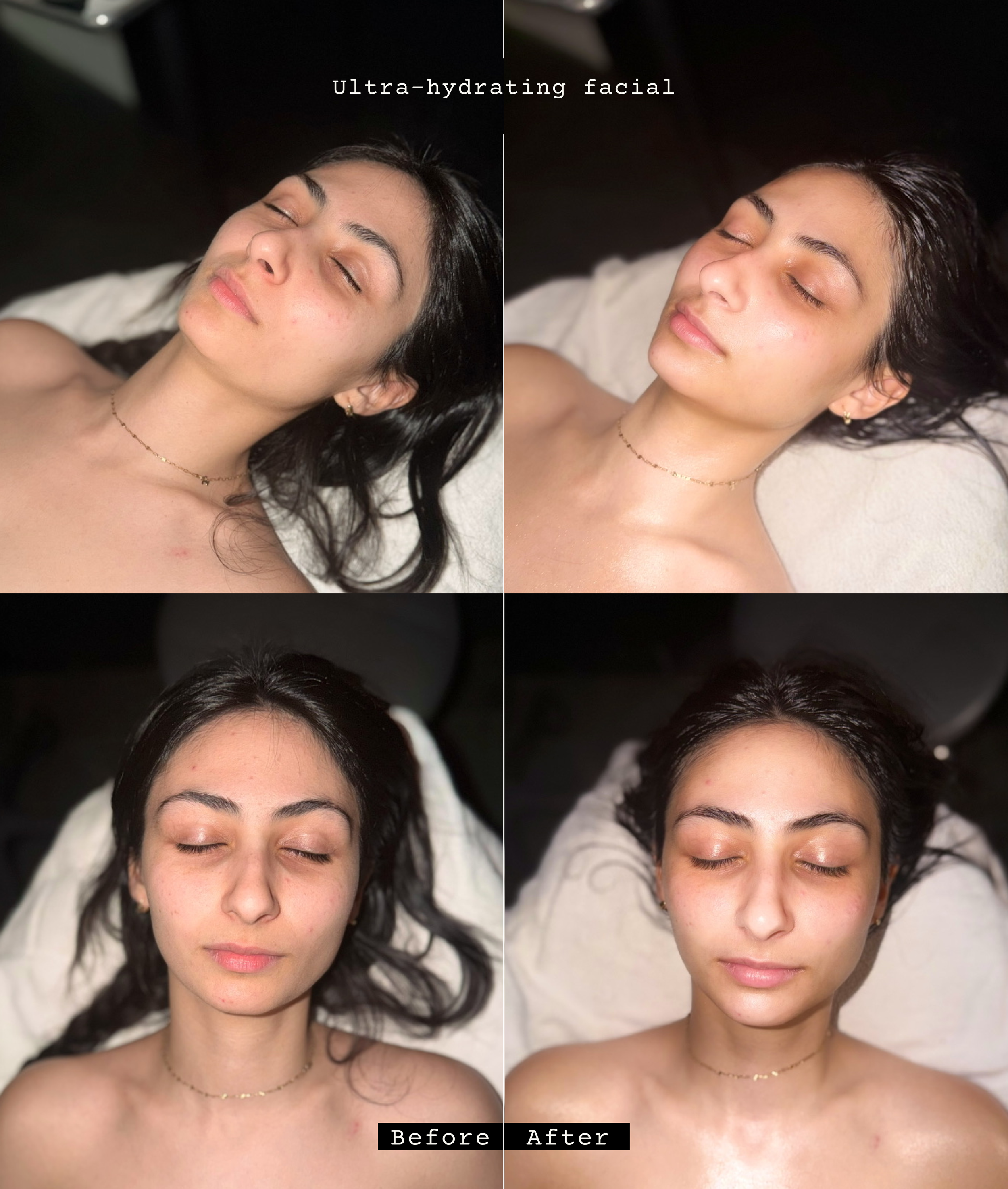 Hydration to the max (we really brought her back to life lol)  Hands down my favorite before and after from just one facial!