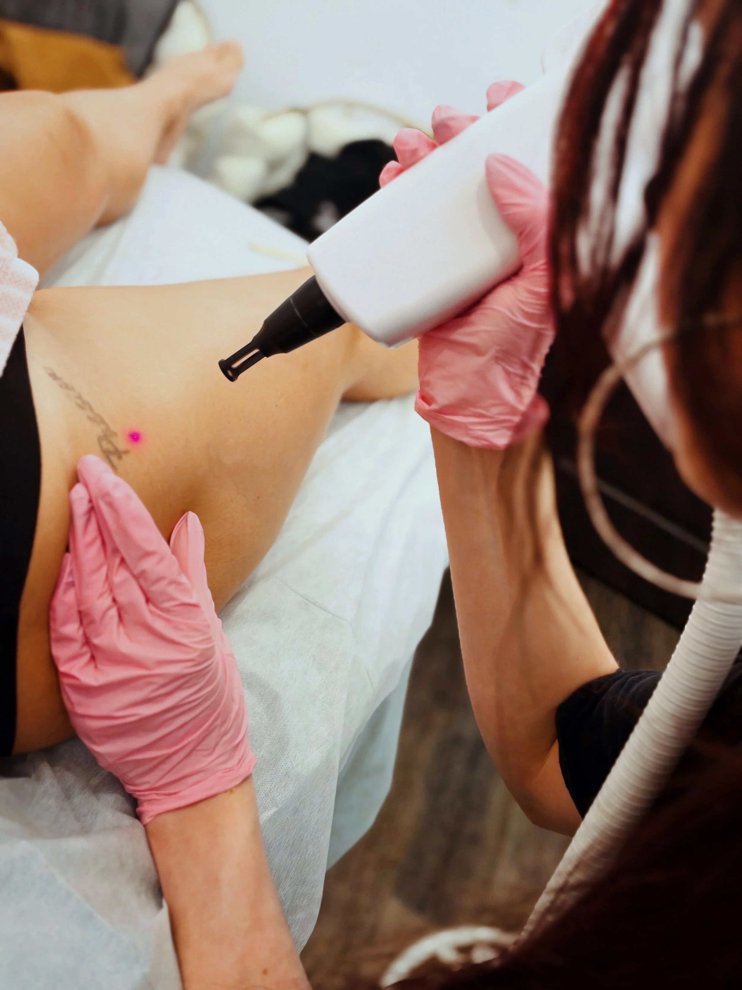 Laser tattoo removal session #2 @ Sona Spa Center