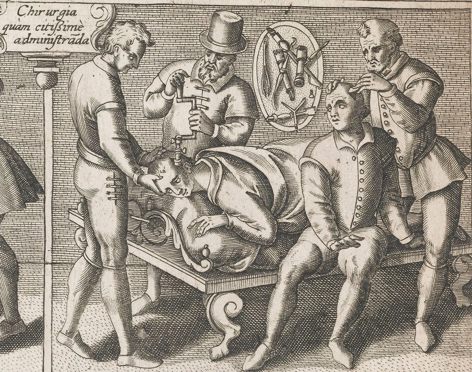 surgeon-trepanning-skull-trephining-patient-procedure-operation.jpg
