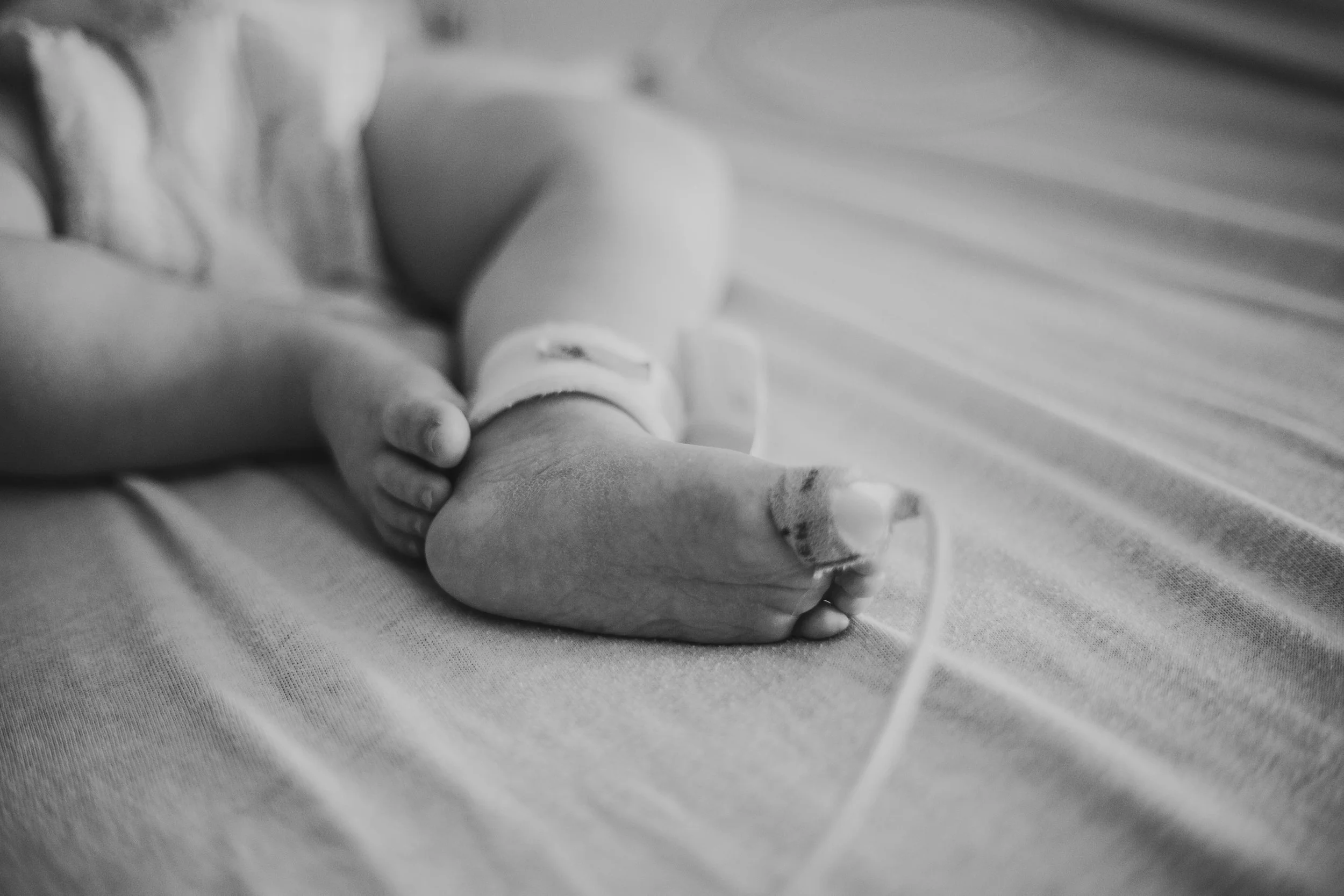 A black and white image of two infant feet connected to medical wires