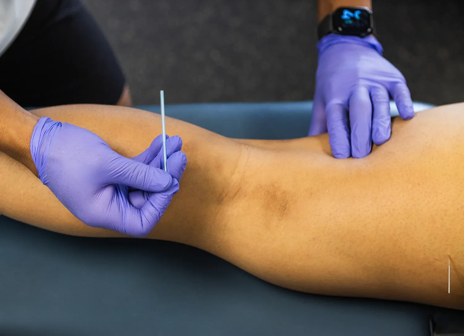 A healthcare professional wearing purple gloves is administering an injection into a person's upper arm while supporting the arm with the other hand.