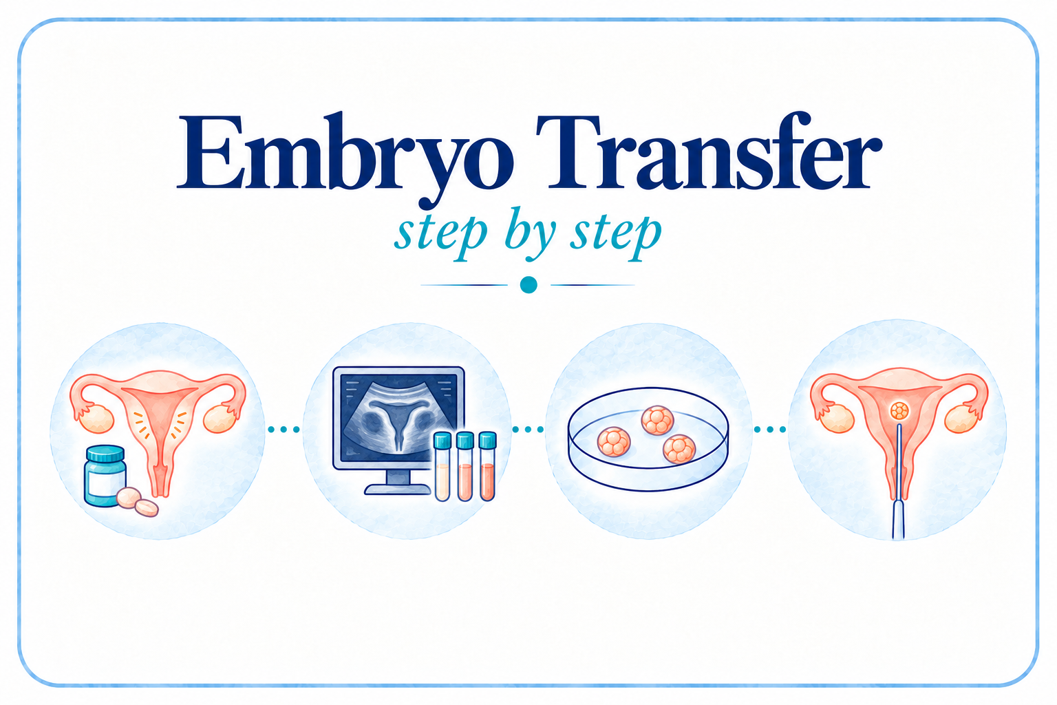 Embryo Transfer: step-by-step