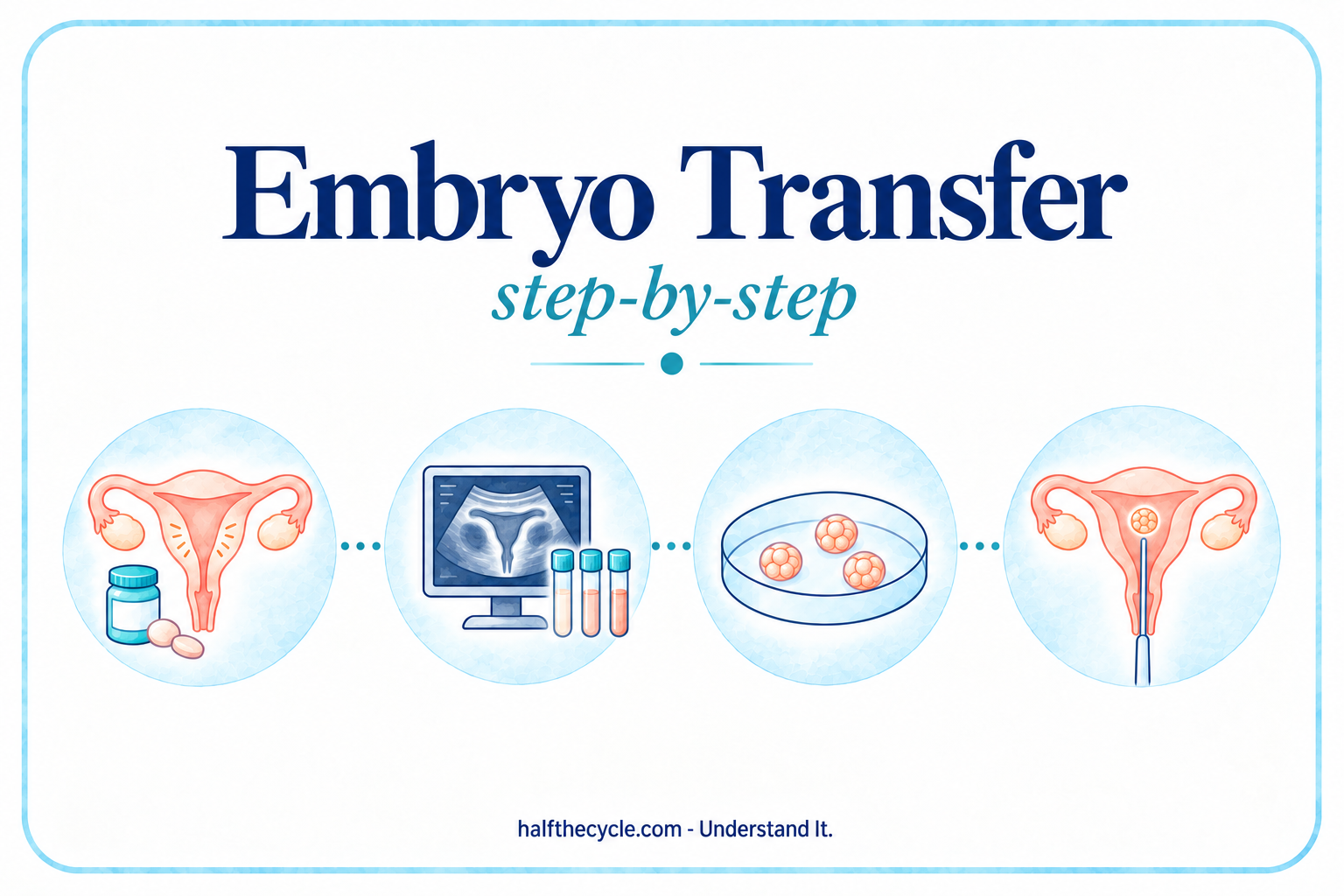 Embryo Transfer: step-by-step