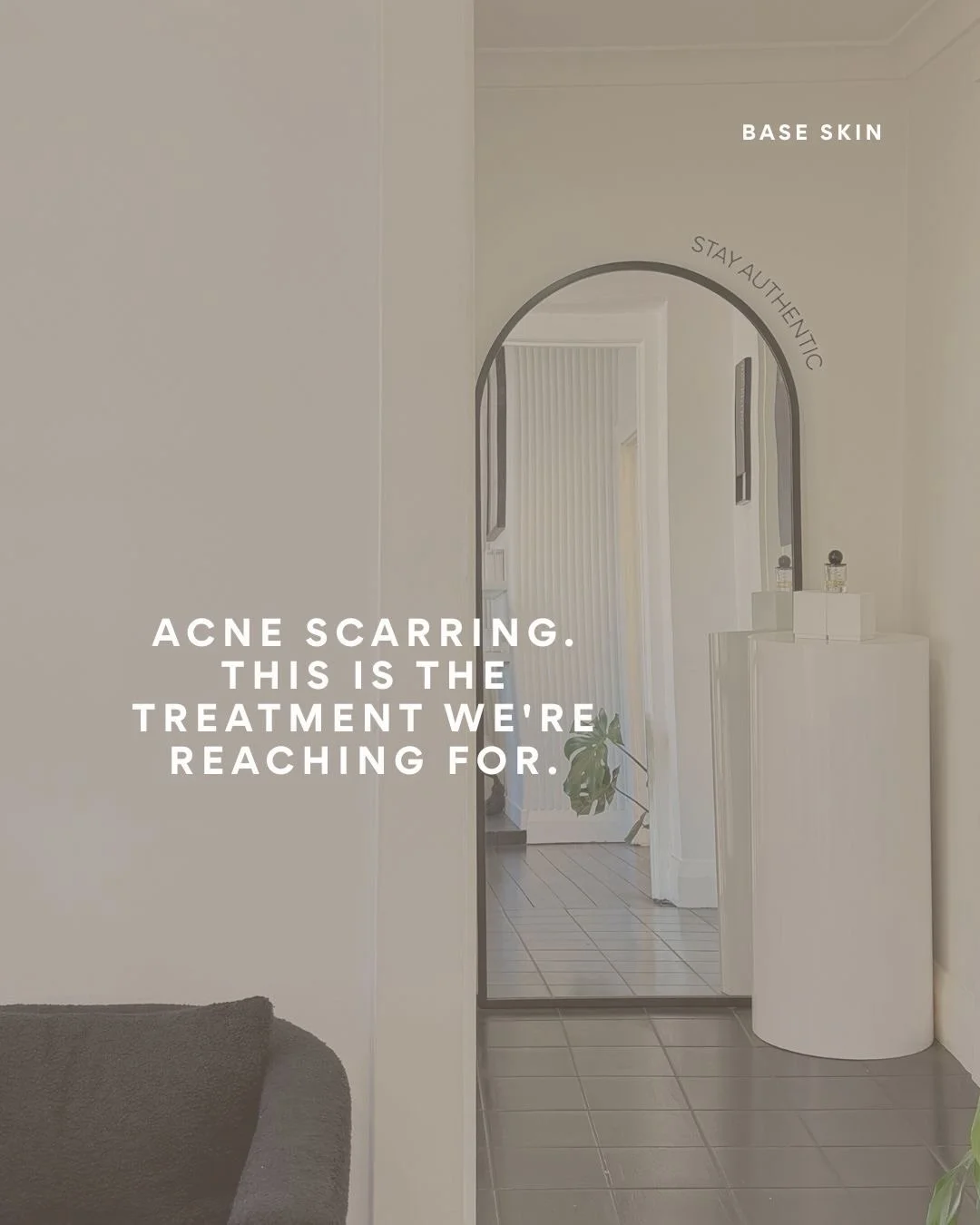 Acne scarring is one of the most common concerns we treat at Base Skin and one of the most misunderstood. 

The right treatment for the right scar type makes all the difference. Swipe to understand why Venus Viva is the treatment we reach for and wha